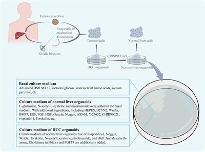 Opportunities and challenges of hepatocellular carcinoma organoids for targeted drugs sensitivity screening